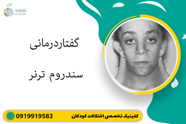 گفتاردرمانی سندروم ترنر